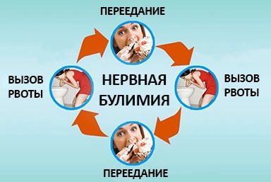 Лечение булимии в Нижней Иволге